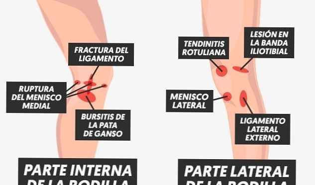 Que puedo tomar para el dolor de rodillas